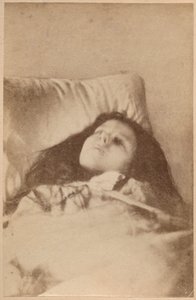 A hisztéria támadása, harmadik fázis, IV. tábla, Bourneville és P. Regnard „Iconographie Photographique de La Salpetriere”-ből, Párizs, 1876 (albumnyomat)
